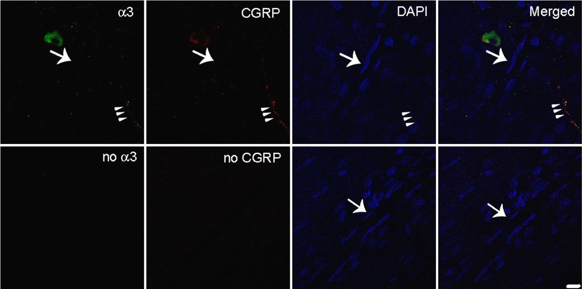 Fig.2.A showing Immunohistochemistry-immunofluorescence in a Rattus norvegicus (Rat) sample from the publication: Na,K-ATPase alpha isoforms at the blood-cerebrospinal fluid-trigeminal nerve and blood-retina interfaces in the rat.