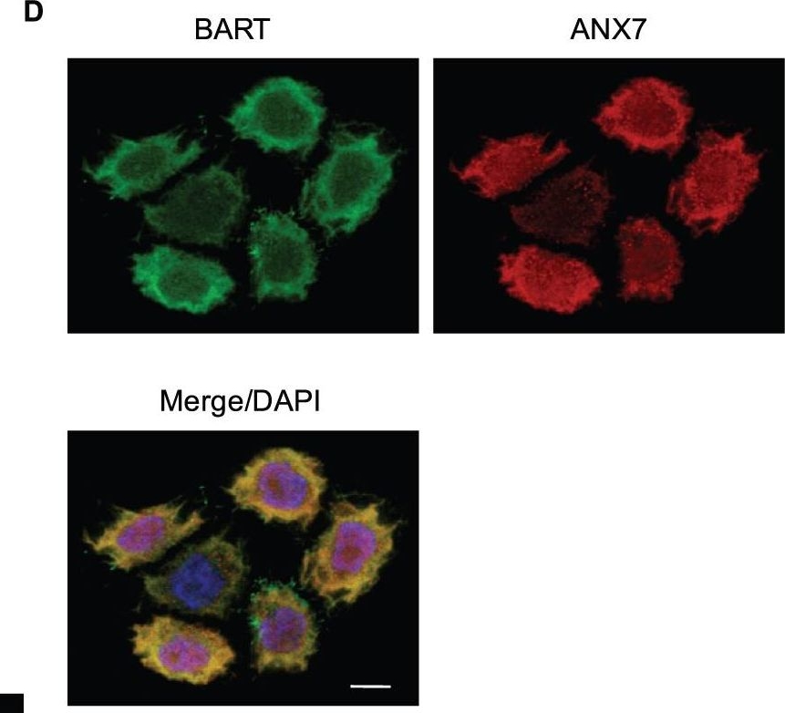 Fig.1.D showing Immunocytochemistry-immunofluorescence in a Homo sapiens (Human) sample from the publication: BART inhibits pancreatic cancer cell invasion by PKCα inactivation through binding to ANX7.