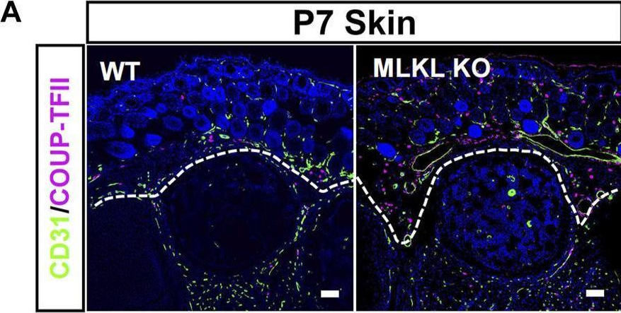 Fig.4.A showing Immunohistochemistry-immunofluorescence in a Mus musculus (House mouse) sample from the publication: Evidence for developmental vascular-associated necroptosis and its contribution to venous-lymphatic endothelial differentiation.