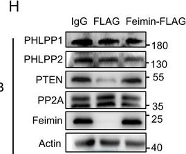 Fig.2.H showing Western Blotting in a Mus musculus (House mouse) sample from the publication: Microglial Feimin Alleviates Cognitive Impairment in High-Fat Diet-Fed Mice.