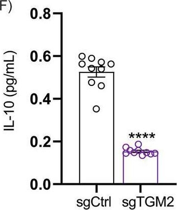 Fig.3.F showing Enzyme-linked immunosorbent assay in a Mus musculus (House mouse) sample from the publication: Transglutaminase 2-expressing macrophages modulate adipose tissue inflammation.