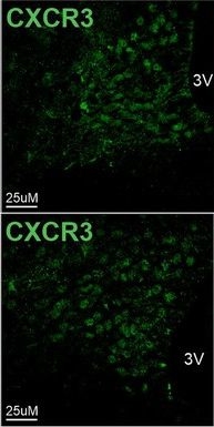 Fig.7.C showing Immunocytochemistry-immunofluorescence in a Mus musculus (House mouse) sample from the publication: CXCR3-expressing myeloid cells recruited to the hypothalamus protect against diet-induced body mass gain and metabolic dysfunction.
