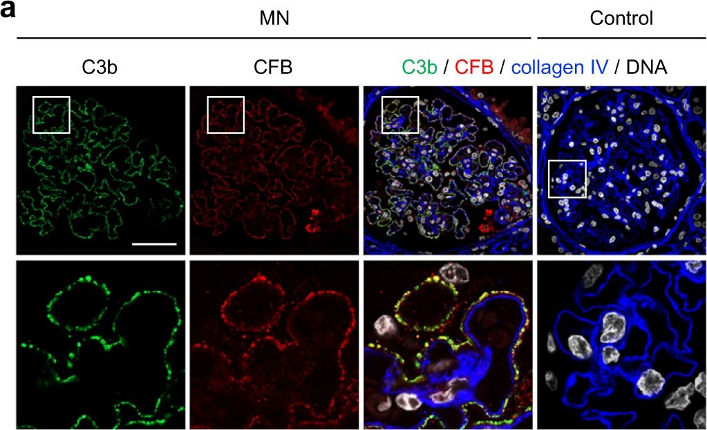 Fig.1.A showing Immunohistochemistry-immunofluorescence in a Homo sapiens (Human) sample from the publication: The classical pathway triggers pathogenic complement activation in membranous nephropathy.