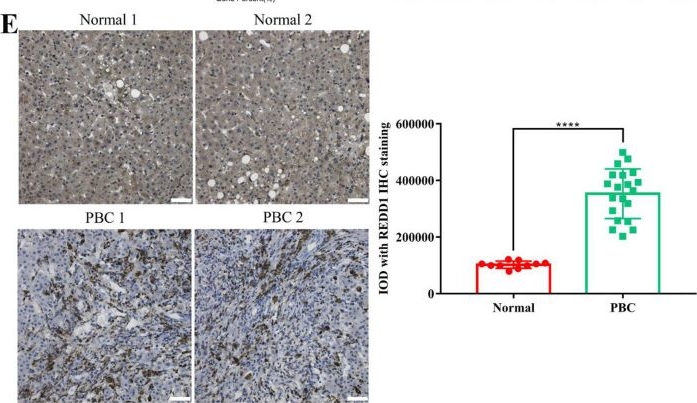 Fig.2.E showing Immunohistochemistry from the publication: REDD1 attenuates cholestatic liver fibrosis and suppresses PI3K/AKT/mTOR pathway.