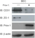 Fig.5.B showing Western Blotting in a Mus musculus (House mouse) sample from the publication: Embryonic vascular endothelial cells are malleable to reprogramming via Prox1 to a lymphatic gene signature.