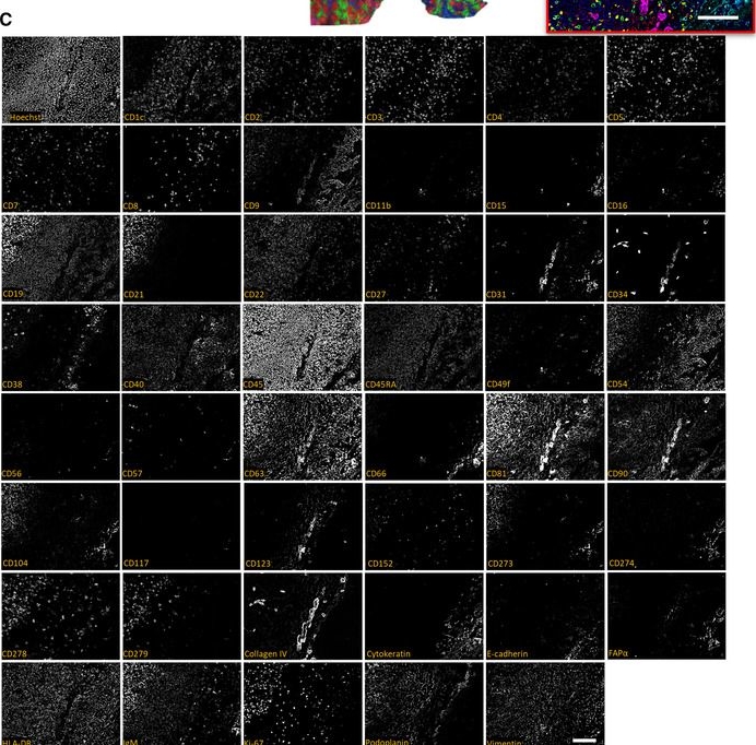 Fig.3.C showing Immunocytochemistry-immunofluorescence in a Homo sapiens (Human) sample from the publication: Highly multiplexed tissue imaging using repeated oligonucleotide exchange reaction.