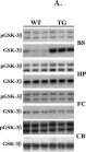 Fig.4.A showing Western Blotting in a Mus musculus (House mouse) sample from the publication: Region-specific tauopathy and synucleinopathy in brain of the alpha-synuclein overexpressing mouse model of Parkinson's disease.