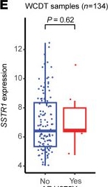 Fig.6.E showing Flow cytometry/Cell sorting in a Homo sapiens (Human) sample from the publication: Genomic and transcriptomic features of androgen receptor signaling inhibitor resistance in metastatic castration-resistant prostate cancer.