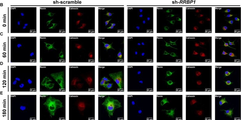 Fig.4.B showing Immunocytochemistry-immunofluorescence from the publication: ER ribosomal-binding protein 1 regulates blood pressure and potassium homeostasis by modulating intracellular renin trafficking.