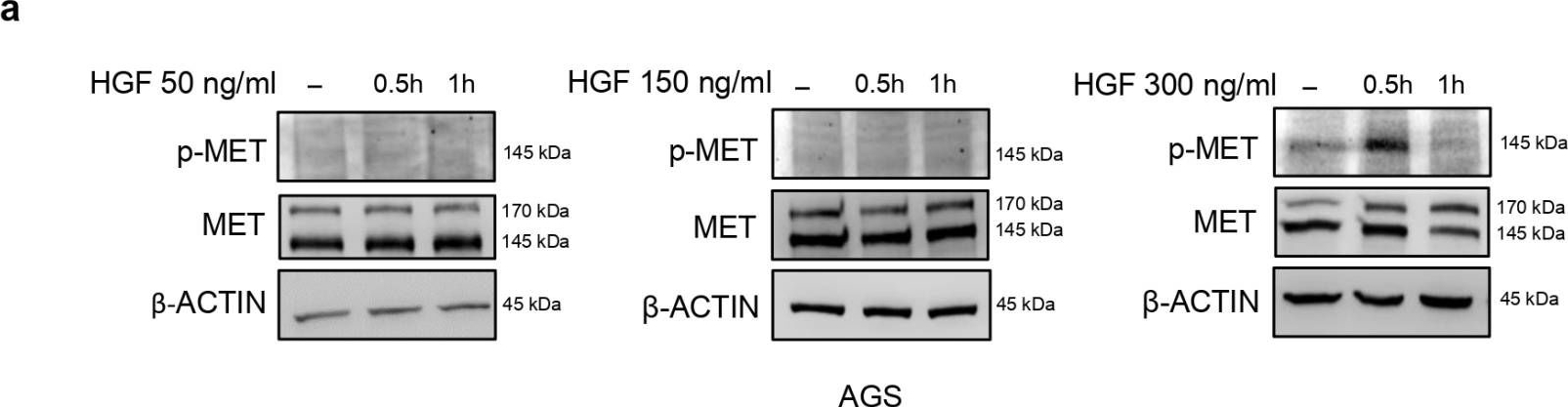 Fig.2.A showing Western Blotting in a Homo sapiens (Human) sample from the publication: SMYD3 Modulates the HGF/MET Signaling Pathway in Gastric Cancer.