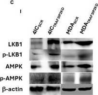Fig.4.C showing Western Blotting from the publication: Targeting TRAF3IP2 disrupts cellular energetics through inhibition of NAMPT in triple negative breast cancer.