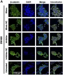 Fig.3.A showing Immunocytochemistry-immunofluorescence in a Homo sapiens (Human) sample from the publication: Exploring the impact of MiR-92a-3p on FOLFOX chemoresistance biomarker genes in colon cancer cell lines.