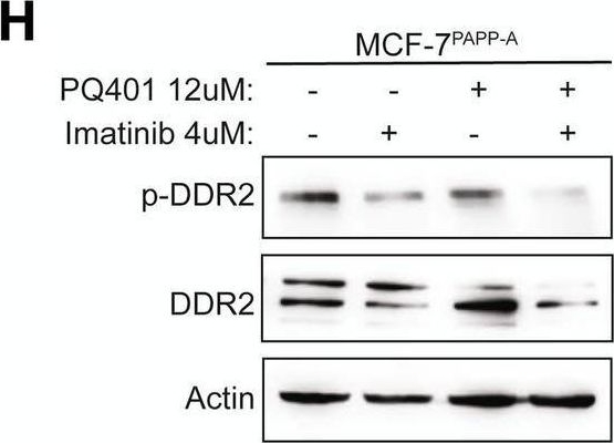 Fig.4.H showing Western Blotting in a Homo sapiens (Human) sample from the publication: Parity predisposes breasts to the oncogenic action of PAPP-A and activation of the collagen receptor DDR2.