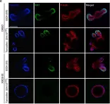 Fig.4.C showing Immunohistochemistry-immunofluorescence in a Mus musculus (House mouse) sample from the publication: ERK5 signalling rescues intestinal epithelial turnover and tumour cell proliferation upon ERK1/2 abrogation.