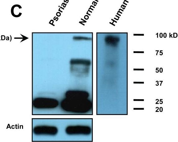 Fig.1.C showing Western Blotting in a Homo sapiens (Human) sample from the publication: Plasmin plays an essential role in amplification of psoriasiform skin inflammation in mice.