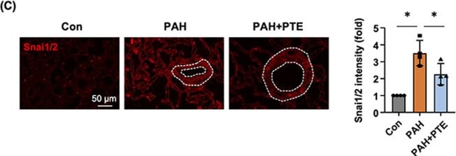 Fig.6.C showing Immunohistochemistry-immunofluorescence from the publication: Pterostilbene mitigates experimental pulmonary arterial hypertension by inhibiting endothelial-to-mesenchymal transition.