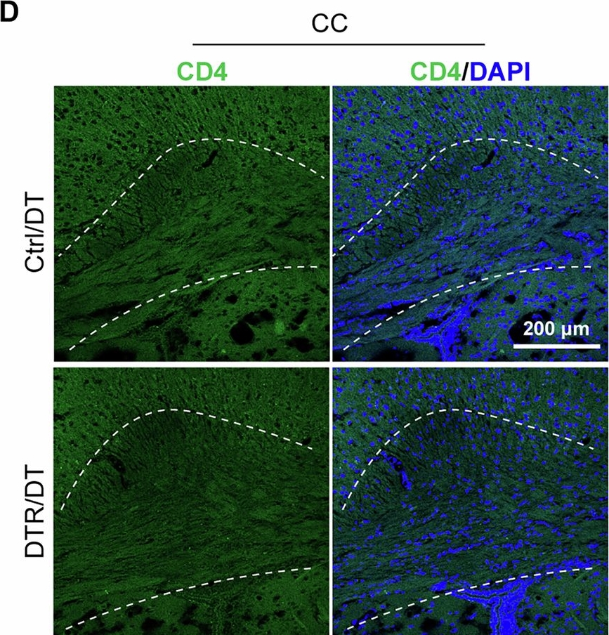 Fig.3.D showing Immunohistochemistry-immunofluorescence in a Mus musculus (House mouse) sample from the publication: Repeated ablations of mature Tmem10+ oligodendrocytes recapitulates key pathological features of multiple sclerosis with prolonged demyelination.
