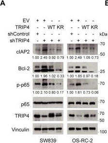 Fig.5.A showing Western Blotting in a Homo sapiens (Human) sample from the publication: BAY11-7082 Targets RNF25 to Reverse TRIP4 Ubiquitination-dependent NF-κB Activation and Apoptosis Resistance in Renal Cell Carcinoma.