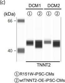 Fig.3.C showing Simple Western - Size in a Homo sapiens (Human) sample from the publication: Pediatric dilated cardiomyopathy caused by TNNT2-R151W mutation: Modeling and rescue in patient-derived induced pluripotent stem cells and engineered heart tissue.