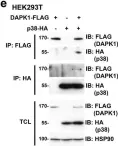 Fig.6.E showing Western Blotting from the publication: Tumor suppressor death-associated protein kinase 1 inhibits necroptosis by p38 MAPK activation.