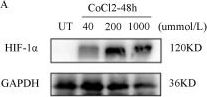 Anti HIF-1 Alpha Antibody (D1S7W) Rabbit mAb | Cell Signaling