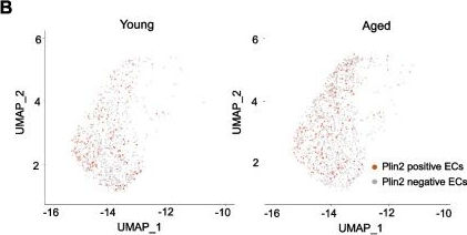 Fig.2.B showing Immunohistochemistry in a Mus musculus (House mouse) sample from the publication: Lipid-laden endothelial cells exhibit a transcriptomic signature linked to blood-brain barrier dysfunction, metabolic reprogramming, and increased inflammation in the aging brain.