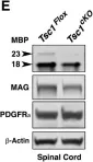 Fig.2.E showing Western Blotting in a Mus musculus (House mouse) sample from the publication: mTORC1 Activation by Loss of Tsc1 in Myelinating Glia Causes Downregulation of Quaking and Neurofascin 155 Leading to Paranodal Domain Disorganization.