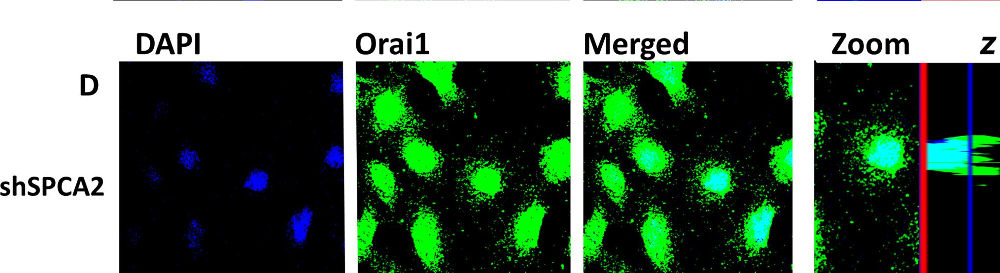 Fig.5.D showing Immunocytochemistry-immunofluorescence in a Mus musculus (House mouse) sample from the publication: SPCA2 regulates Orai1 trafficking and store independent Ca2+ entry in a model of lactation.