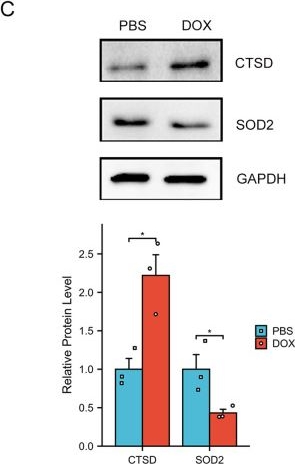 Fig.7.C showing Western Blotting from the publication: Bioinformatics analyses reveal the autophagy-related feature biomarkers in dilated cardiomyopathy with heart failure.