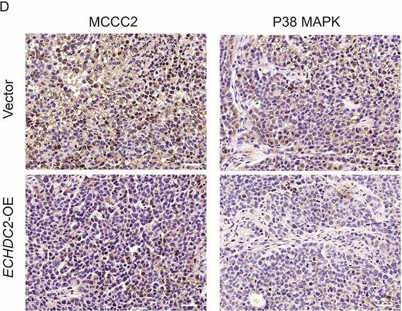 Fig.5.D showing Immunohistochemistry from the publication: ECHDC2 inhibits the proliferation of gastric cancer cells by binding with NEDD4 to degrade MCCC2 and reduce aerobic glycolysis.