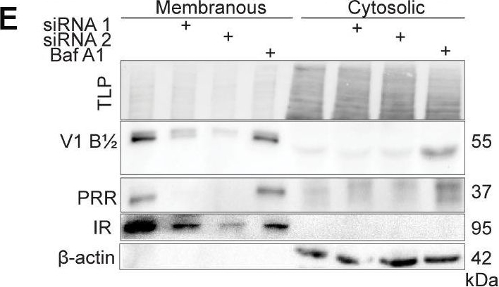 Fig.4.E showing Western Blotting in a Homo sapiens (Human) sample from the publication: V-ATPase-associated prorenin receptor is upregulated in prostate cancer after PTEN loss.