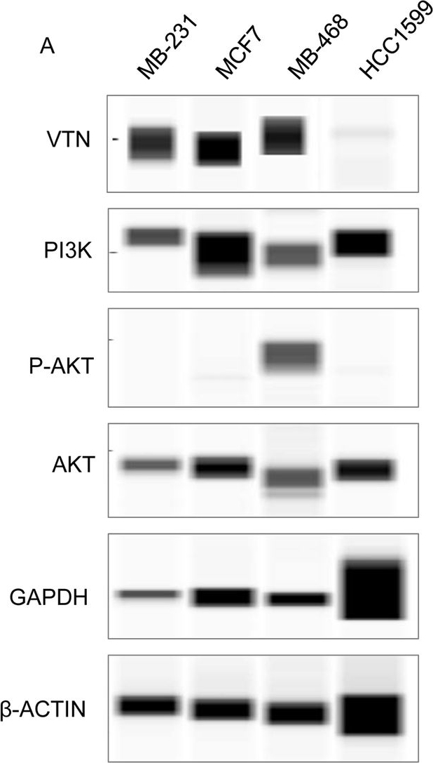 Fig.5.A showing Western Blotting in a Homo sapiens (Human) sample from the publication: Functional role of vitronectin in breast cancer.