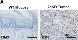 Fig.4.A showing Immunohistochemistry from the publication: T-cell immunoglobulin mucin 3 blockade drives an antitumor immune response in head and neck cancer.