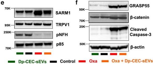 Fig.10.E showing Western Blotting in a Homo sapiens (Human) sample from the publication: Small extracellular vesicles ameliorate peripheral neuropathy and enhance chemotherapy of oxaliplatin on ovarian cancer.