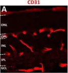 Fig.5.A showing Immunohistochemistry in a Mus musculus (House mouse) sample from the publication: In Utero Alcohol Exposure Impairs Retinal Angiogenesis and the Microvessel-Associated Positioning of Calretinin Interneurons.