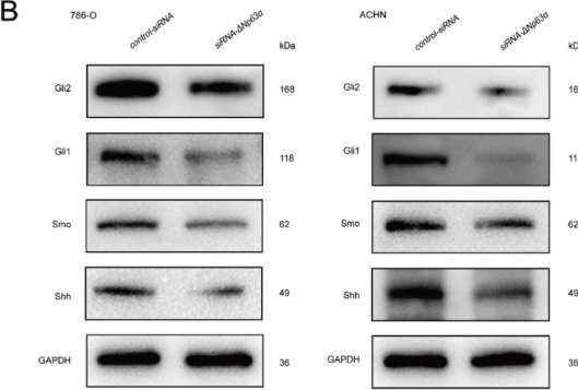 Fig.6.B showing Western Blotting from the publication: ΔNp63α promotes cigarette smoke-induced renal cancer stem cell activity via the Sonic Hedgehog pathway.