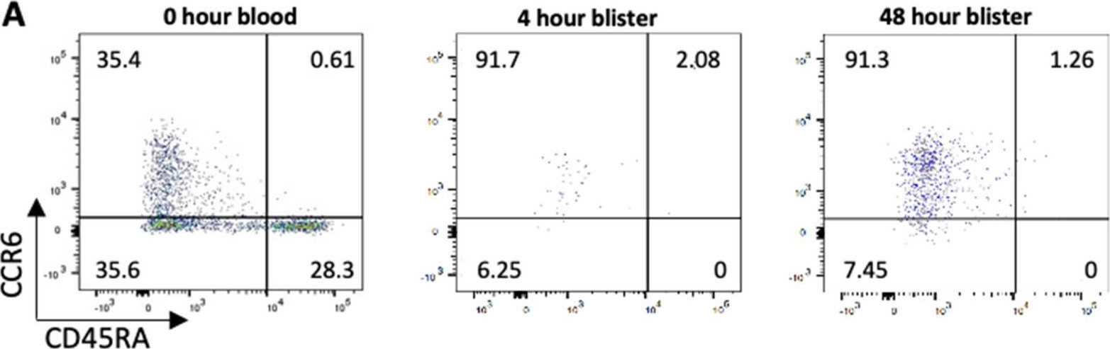 Fig.4.A showing Flow cytometry/Cell sorting from the publication: A novel Streptococcus pneumoniae human challenge model demonstrates Treg lymphocyte recruitment to the infection site.