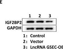Fig.3.E showing Western Blotting from the publication: LncRNA GSEC impedes the reprogramming of glucose metabolism in papillary thyroid carcinoma by inhibiting the IGF2BP2/GLUT1 axis.