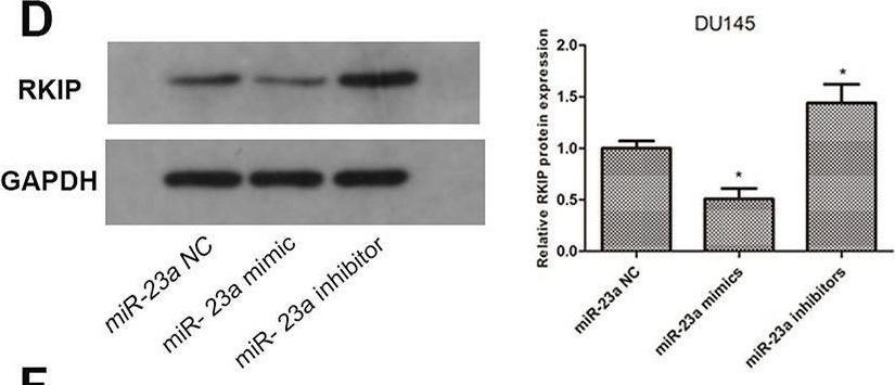 Fig.5.D showing Western Blotting in a Homo sapiens (Human) sample from the publication: LncRNA XIST acts as a tumor suppressor in prostate cancer through sponging miR-23a to modulate RKIP expression.