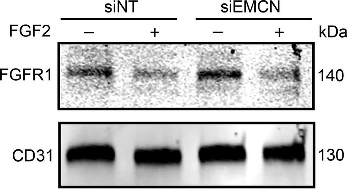 Fig.5.B from the publication: Endomucin selectively regulates vascular endothelial growth factor receptor-2 endocytosis through its interaction with AP2.