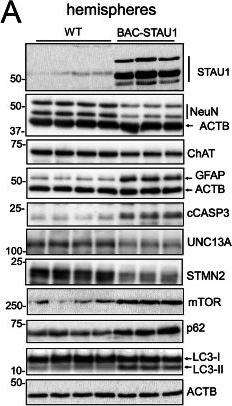 Fig.3.A showing Western Blotting from the publication: A human Staufen1 BAC transgenic mouse exhibits abnormal autophagy and neurodegeneration across the central nervous system.
