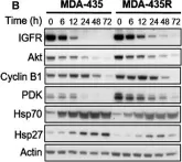 Fig.4.B showing Western Blotting in a Homo sapiens (Human) sample from the publication: Histone deacetylase activity mediates acquired resistance towards structurally diverse HSP90 inhibitors.