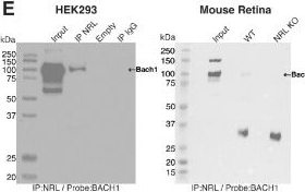 Fig.1.E showing Western Blotting from the publication: Stress Responsive bZIP Transcription Factors ATF4 and BACH1 Cooperate With MAF-Family bZIP Protein NRL to Fine-Tune Rod Photoreceptor Gene Expression.