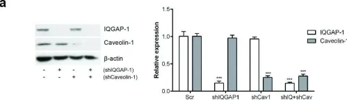 Fig.5.A showing Western Blotting from the publication: Diet-induced hypercholesterolemia promotes androgen-independent prostate cancer metastasis via IQGAP1 and caveolin-1.