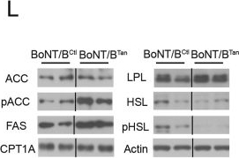 Fig.3.L showing Western Blotting from the publication: Tanycytic transcytosis inhibition disrupts energy balance, glucose homeostasis and cognitive function in male mice.