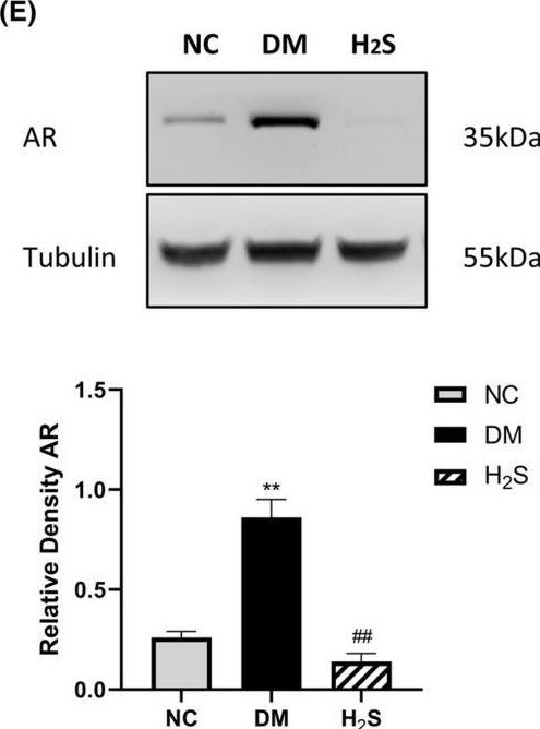 Fig.5.E showing Western Blotting in a Rattus norvegicus (Rat) sample from the publication: Hydrogen sulfide alleviates neural degeneration probably by reducing oxidative stress and aldose reductase expression.