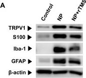 Fig.3.A showing Western Blotting from the publication: Repetitive transcranial magnetic stimulation suppresses glia-associated neuroinflammation and promotes peripheral nerve recovery in neuropathic pain.