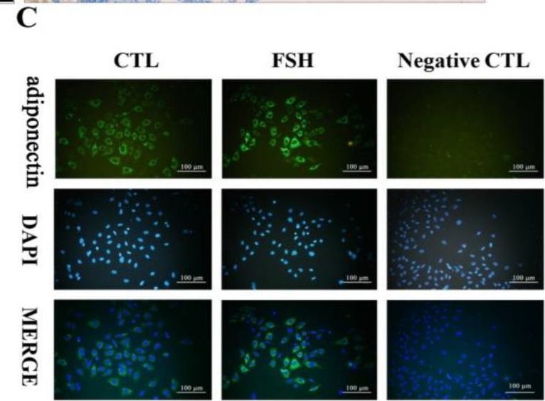 Fig.1.C showing Immunocytochemistry-immunofluorescence in a Rattus norvegicus (Rat) sample from the publication: Regulation and Role of Adiponectin Secretion in Rat Ovarian Granulosa Cells.