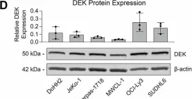 Fig.2.D showing Western Blotting from the publication: DEK regulates B-cell proliferative capacity and is associated with aggressive disease in low-grade B-cell lymphomas.
