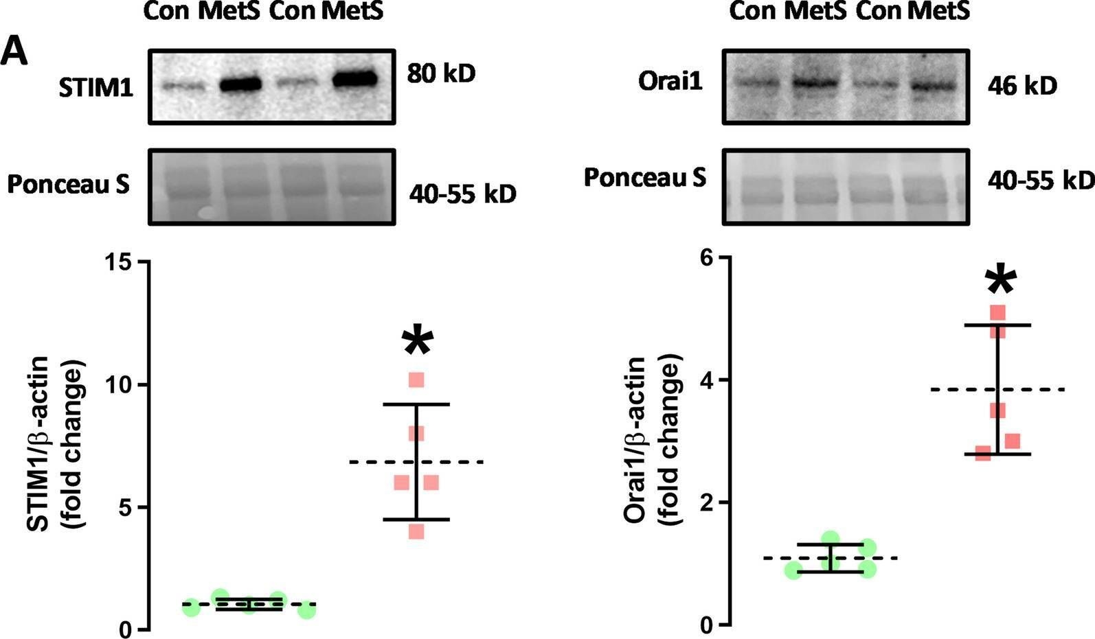 Fig.5.A showing Western Blotting in a Rattus norvegicus (Rat) sample from the publication: STIM1-Orai1 interaction mediated calcium influx activation contributes to cardiac contractility of insulin-resistant rats.